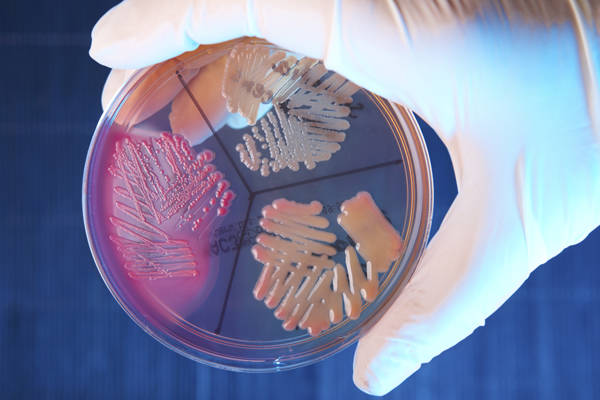 Gut Microbiome