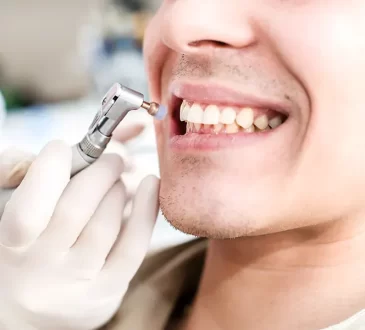 Dental Cleaning