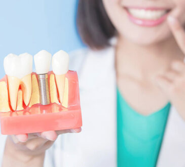 Dental Implant Outcomes