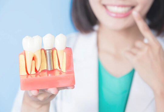 Dental Implant Outcomes