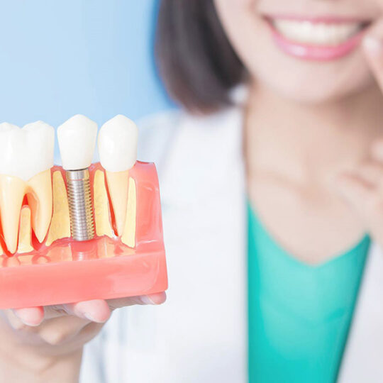 Dental Implant Outcomes