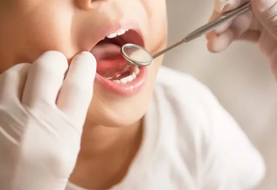 Dental Sealants